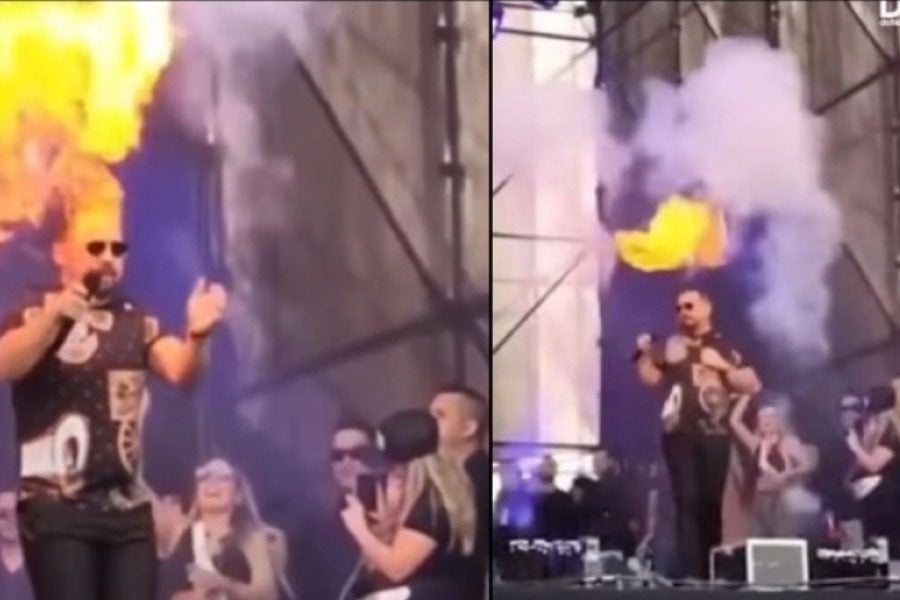 Βραζιλιάνος τραγουδιστής άρπαξε φωτιά από τα εφέ της σκηνής την ώρα της συναυλίας - Ο τραγουδιστής Xand Aviao έκαψε το δεξί του χέρι 