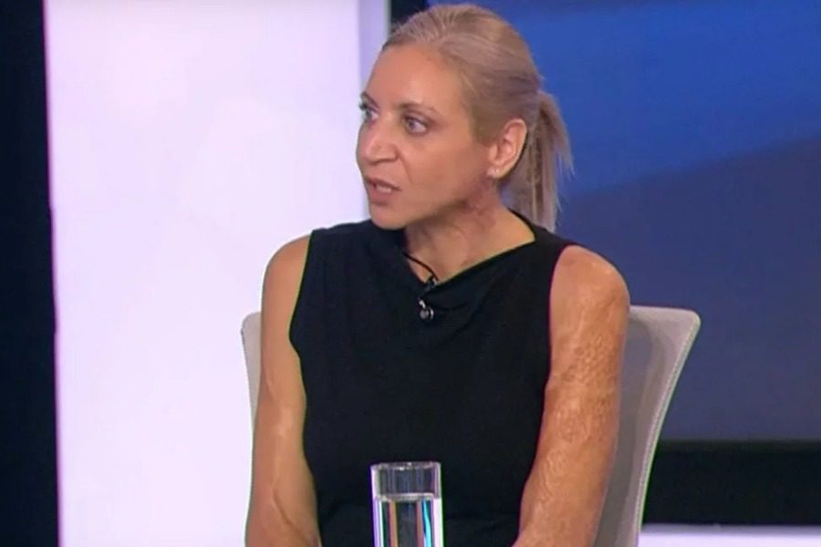 Φωτιά στο Μάτι: «Έβλεπα να λιώνουν τα πόδια του γιου μου και δεν του είπα τίποτα ως μαμά»
