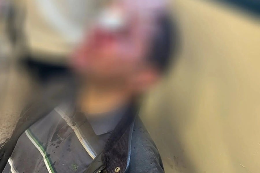 Ευθύνες στην ΕΛ.ΑΣ. αποδίδει το ΕΚΠΑ για την αιματηρή επίθεση κουκουλοφόρων στη Νομική