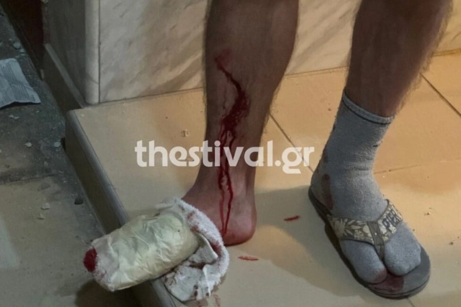 Τρομοκρατία «βλέπουν» οι Αρχές πίσω από την έκρηξη με τους 2 τραυματίες σε πολυκατοικία στη Θεσσαλονίκη