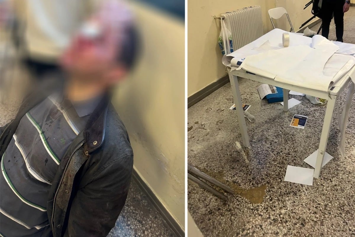 «Το ότι ζει το παιδί είναι θαύμα» – Μαρτυρίες και φωτογραφίες από την άγρια επίθεση κουκουλοφόρων στη Νομική Αθηνών