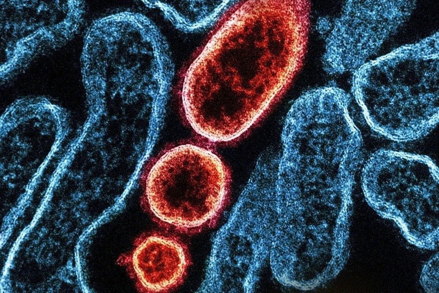 Ιός Nipah: Έχει θνησιμότητα 40 με 50 τοις εκατό - Ποιες οι πιθανότητες να φτάσει στην Ελλάδα